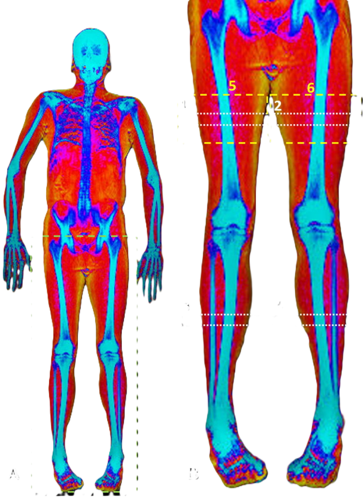 whole body dexa scan image