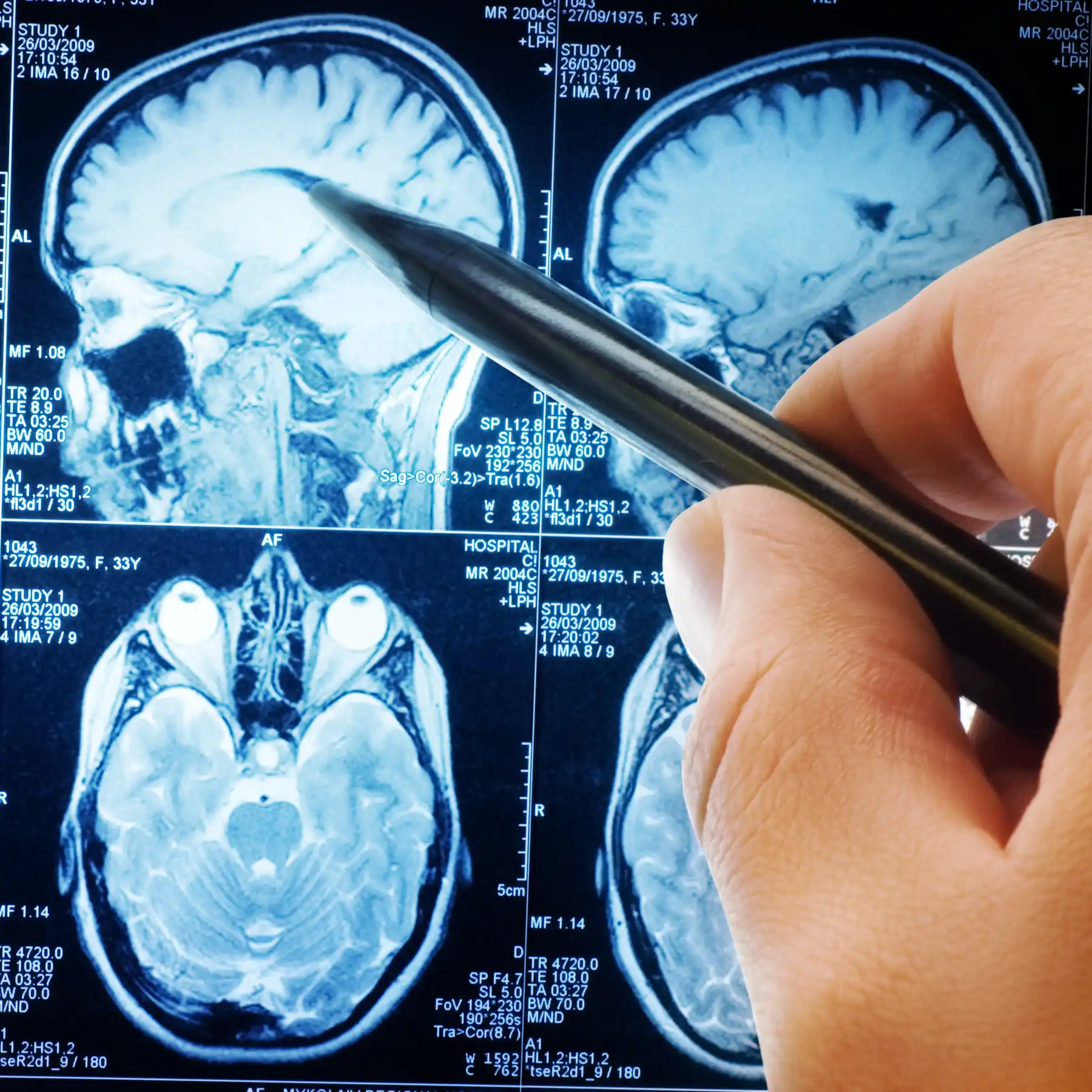 neuroradiology scans being examined