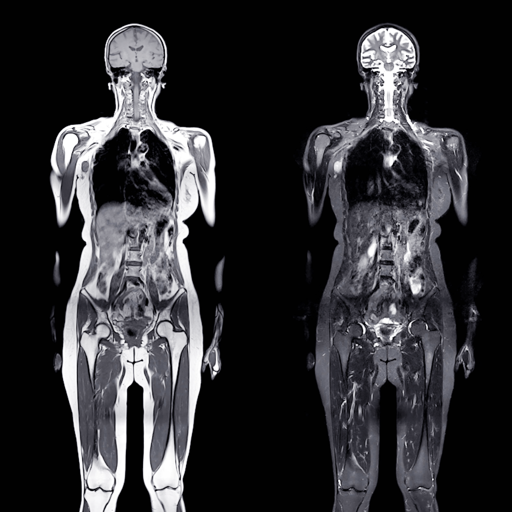 Full body MRI example