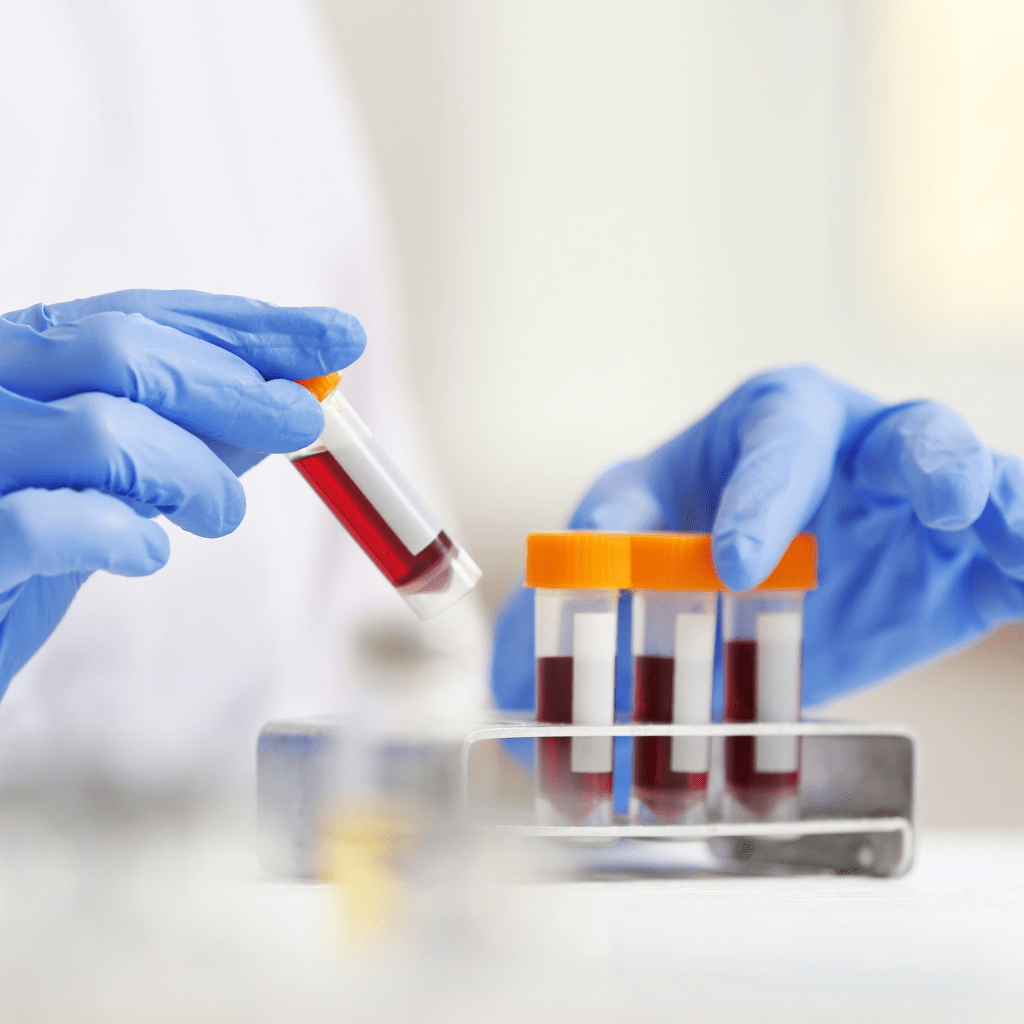 Lab Screening
