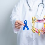 Colon cancer awareness picture