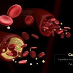 Calcium Build up in veins/arteries