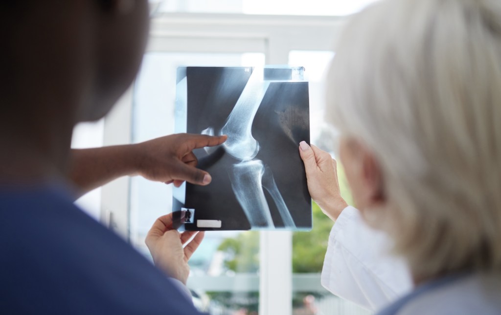 Doctor and patient looking at an X-Ray
